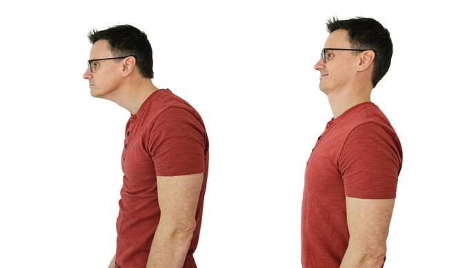 before-after-FHP1-3357171014