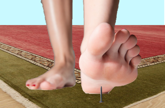gomheceprug